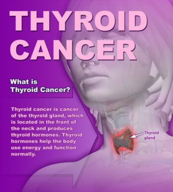 thyroid_cancer_01.jpg